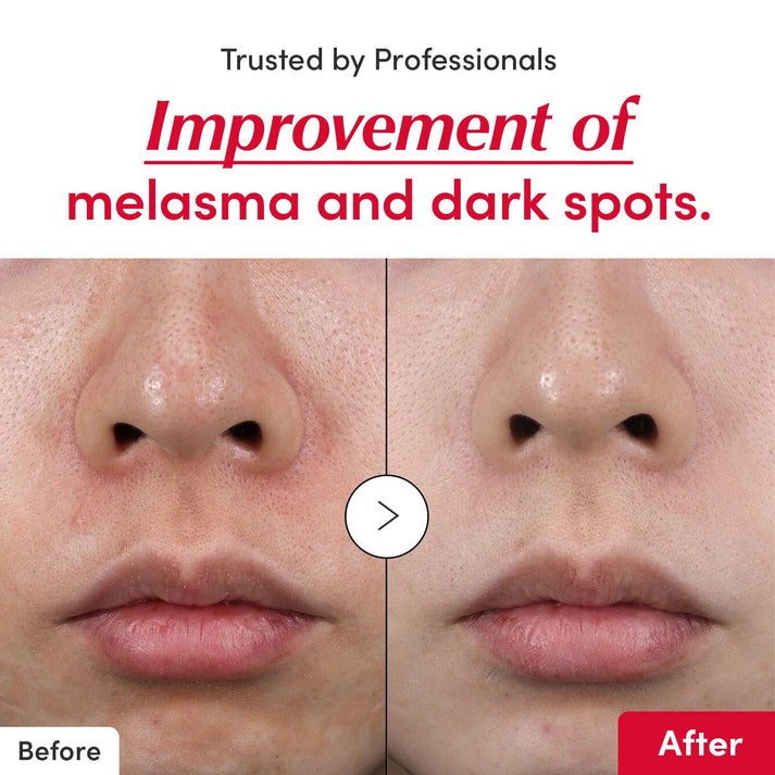 FurCaper™ Vitamin C Serum – Brightens, hydrates & strengthens skin.