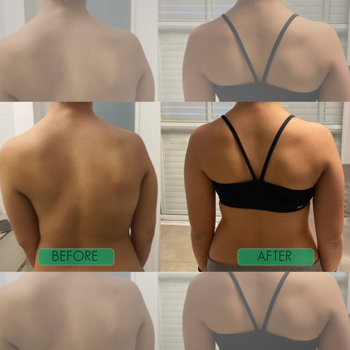 FurCaper™The 30-Second Shortcut to Perfect Posture. (LIMITED BOGO SALE)