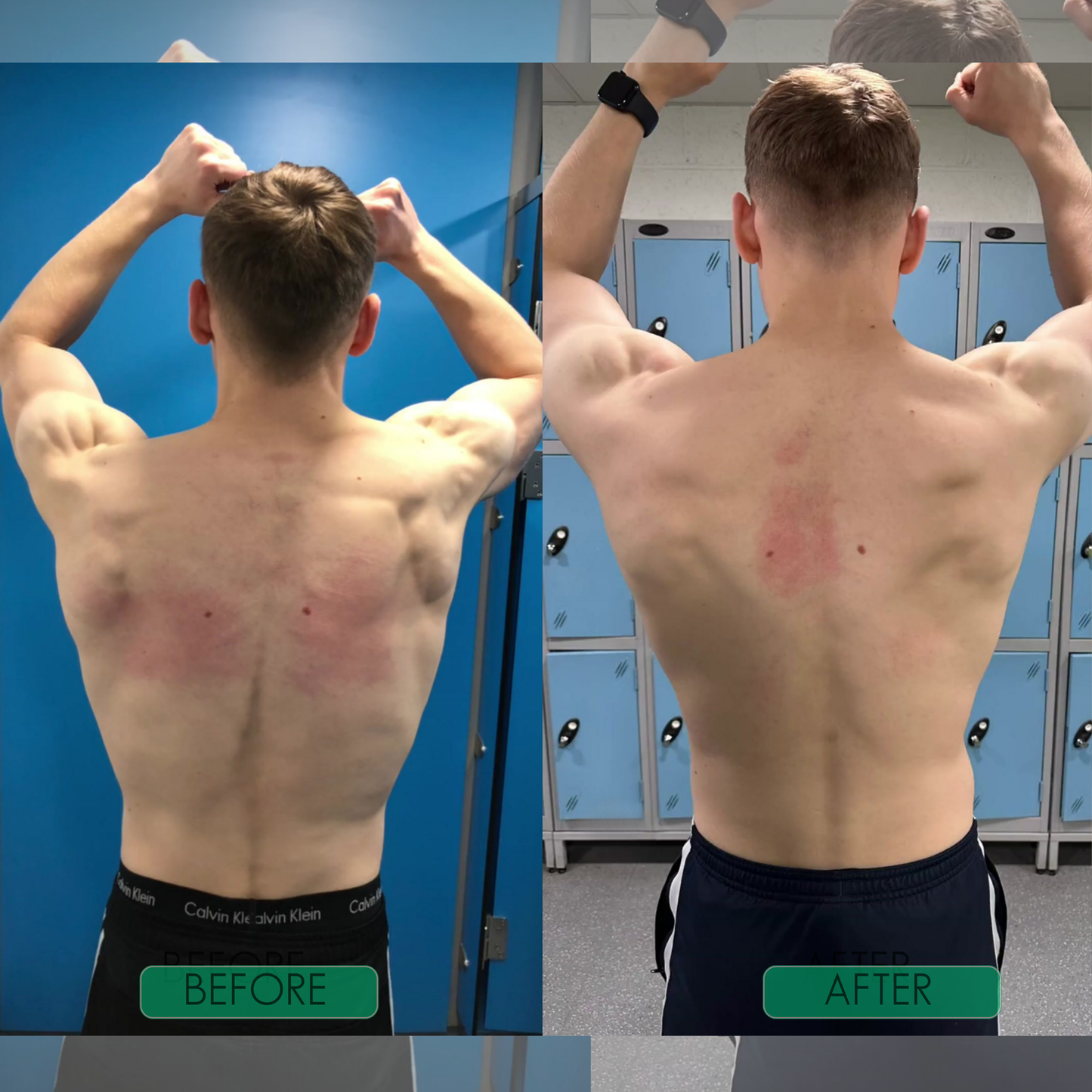 FurCaper™The 30-Second Shortcut to Perfect Posture. (LIMITED BOGO SALE)