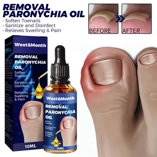 Herbal Ingrown Toenail Corrector Serum