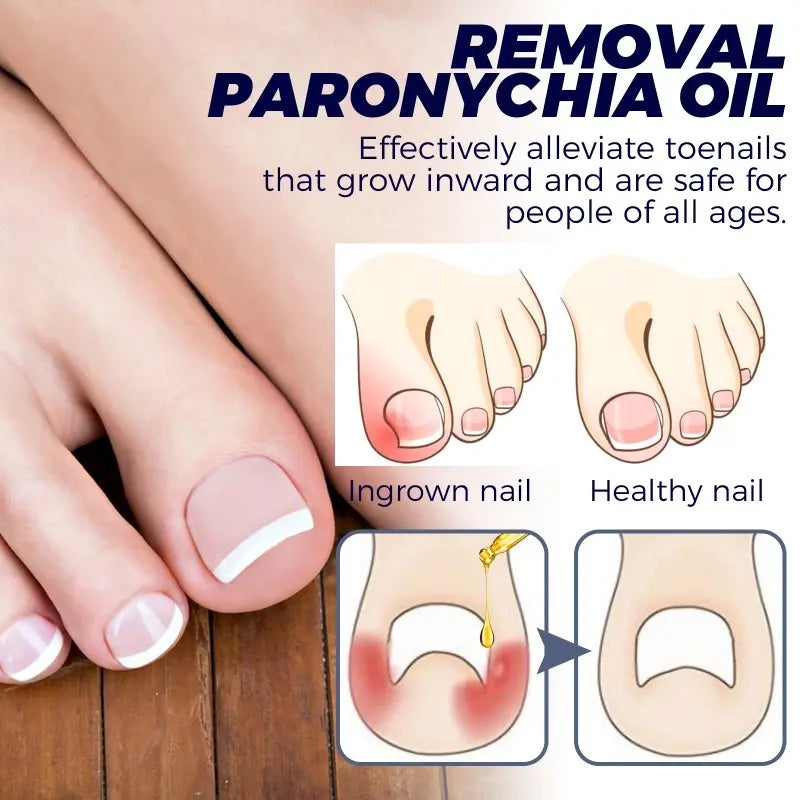 Herbal Ingrown Toenail Corrector Serum