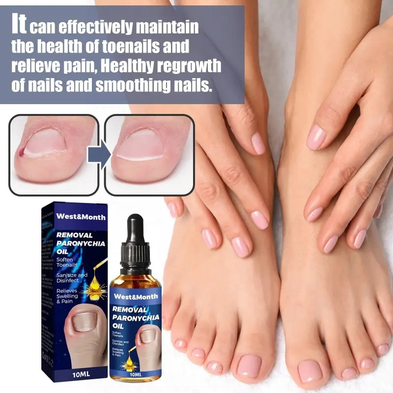 Herbal Ingrown Toenail Corrector Serum
