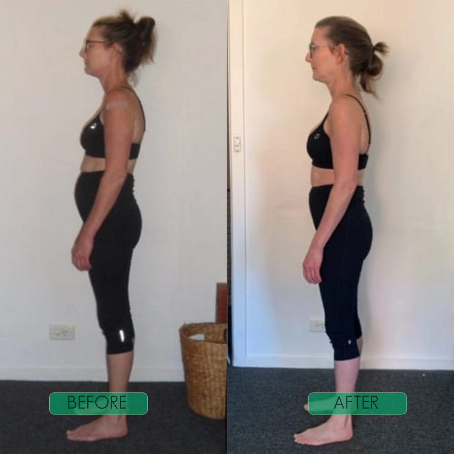 FurCaper™The 30-Second Shortcut to Perfect Posture. (LIMITED BOGO SALE)