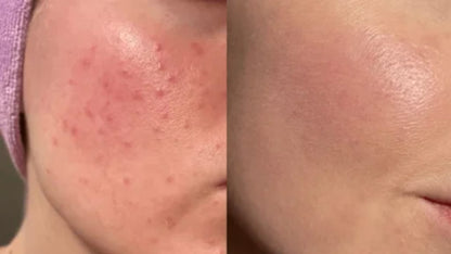 FurCaper™ Exfoliating Gel