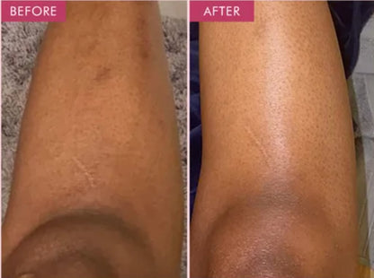 FurCaper™ Exfoliating Gel