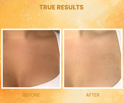 FurCaper™ Exfoliating Gel