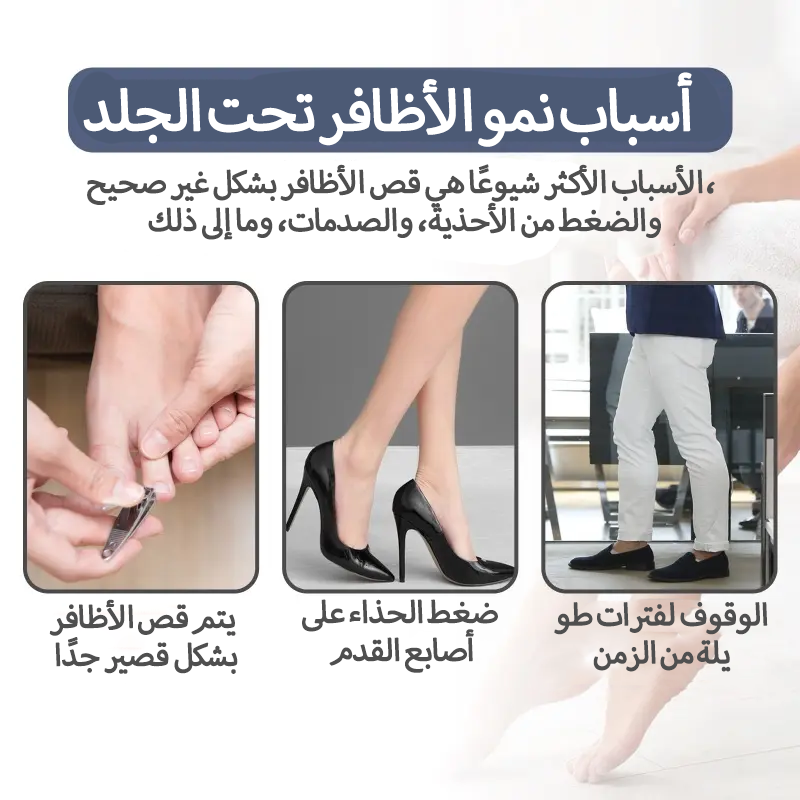 سيروم عشبي لتصحيح أظافر القدم النامية تحت الجلد
