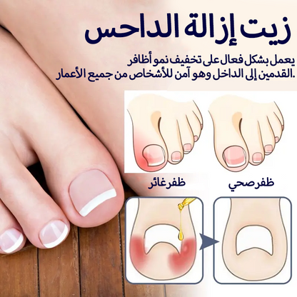 سيروم عشبي لتصحيح أظافر القدم النامية تحت الجلد